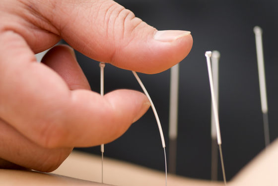 100pcs/Box Disposable Acupuncture Sterile Needles For Medical Acupuncture