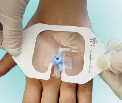 Sterile Adhesive IV Cannula Fixing Dressing Transparent Wound Medical Dressing