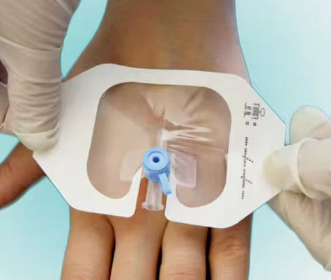 Sterile Adhesive IV Cannula Fixing Dressing Transparent Wound Medical Dressing