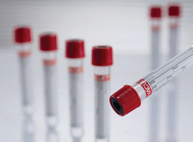 Red Cap Plasma Separation Tube Vacuum Blood Collection Tube No Additive Tube