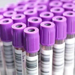 5ml EDTA K2 K3 Tube PET Or Glass Blood Collection Tube