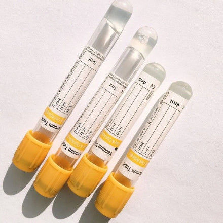 CE Certified Vacuum Venous Yellow Cap Gel Clot Activator Serum Blood Collection Tube