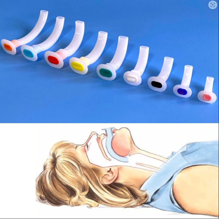 Cheap Price Disposable Guedel Type Oral Airway Various Sizes Oropharyngeal Airway