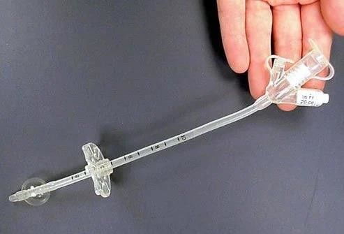 Medical Silicone Gastrostomy Feeding Tube PEG For Percutaneous Endoscopic Gastrostomy Different Sizes