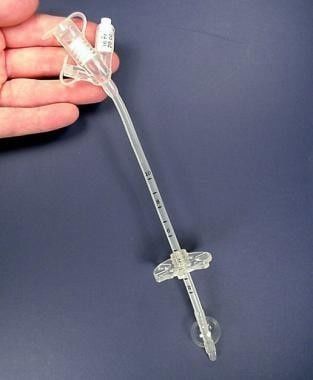 Medical Silicone Gastrostomy Feeding Tube PEG For Percutaneous Endoscopic Gastrostomy Different Sizes